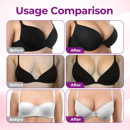 SEAGRIL® Targeted Breast Enhancement Advanced Nano Microneedle Patch