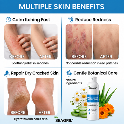 SEAGRIL® Magnesium Botanic Spray| Advanced Skin Recovery for Psoriasis & Eczema | Rapid Soothing, Steroid-Free