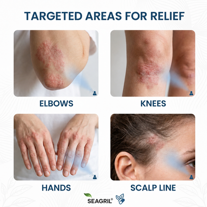 SEAGRIL® Magnesium Botanic Spray| Advanced Skin Recovery for Psoriasis & Eczema | Rapid Soothing, Steroid-Free