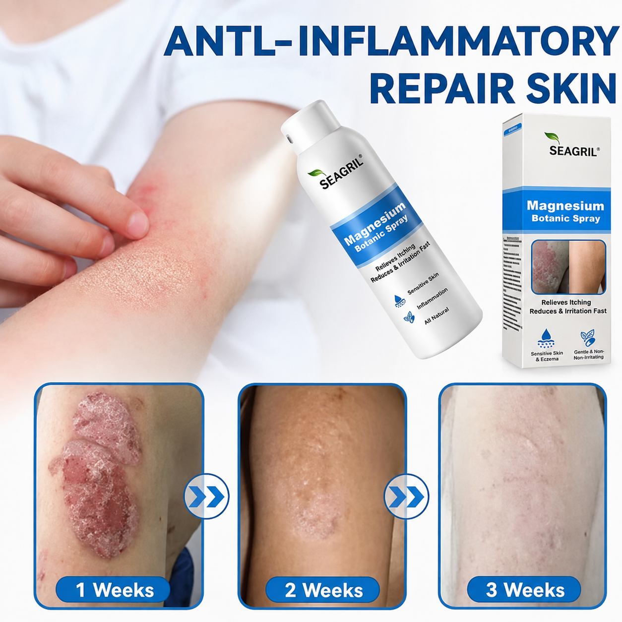 SEAGRIL® Magnesium Botanic Spray| Advanced Skin Recovery for Psoriasis & Eczema | Rapid Soothing, Steroid-Free