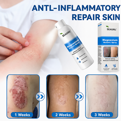 SEAGRIL® Magnesium Botanic Spray| Advanced Skin Recovery for Psoriasis & Eczema | Rapid Soothing, Steroid-Free